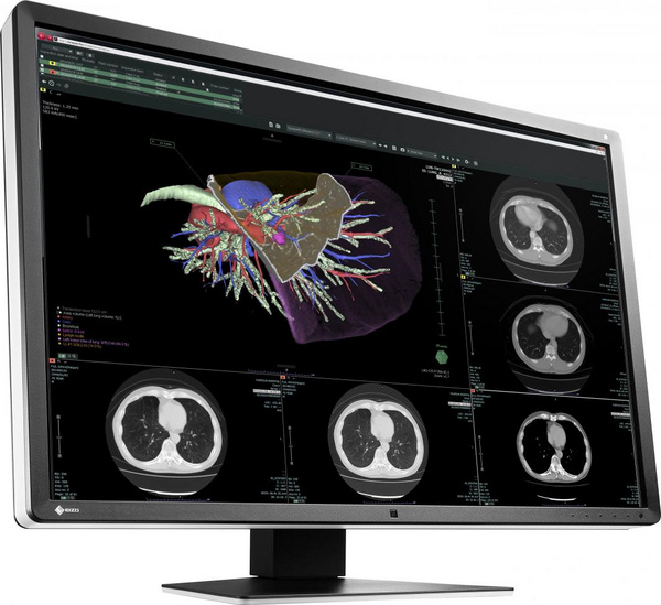 Monitor Eizo RadiForce RX660 30 ", i zi