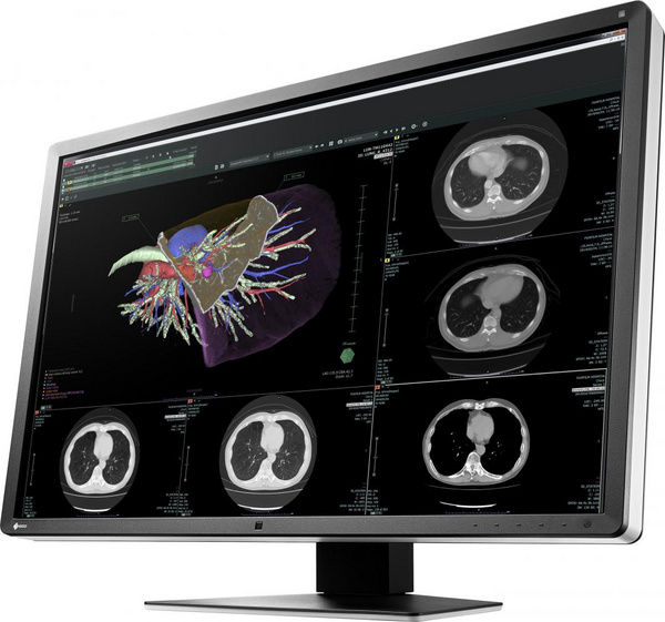 Monitor Eizo RadiForce RX660 30 ", i zi