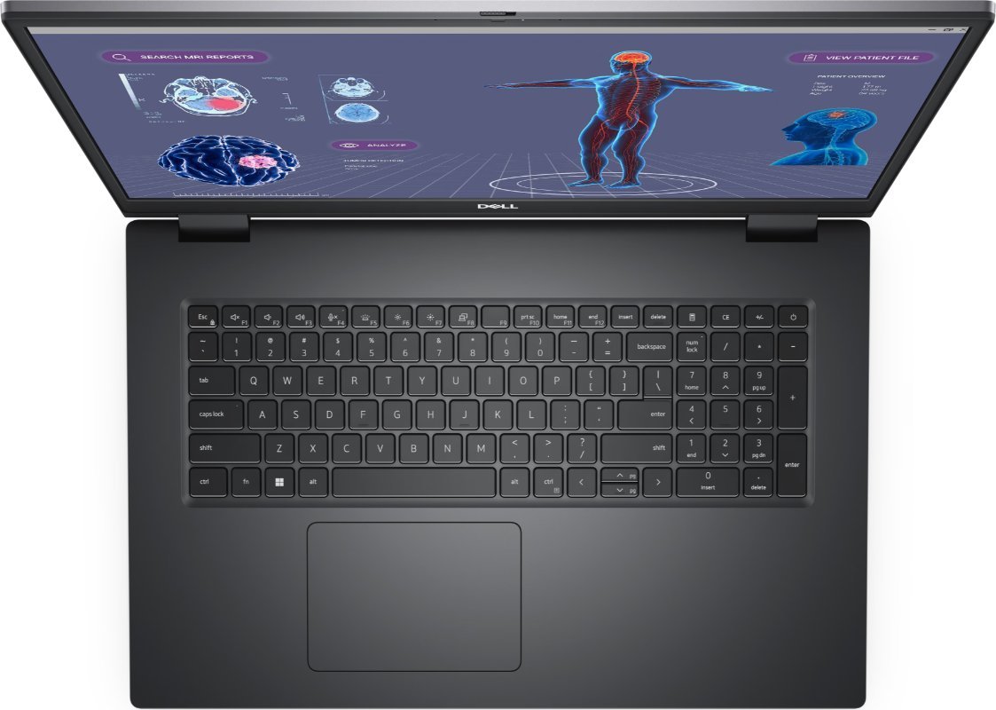 Лаптоп Dell Precision 7780, 17.3\", i7 13850HX, 32GB RAM, 1TB SSD, RTX 2000 8GB, црн
