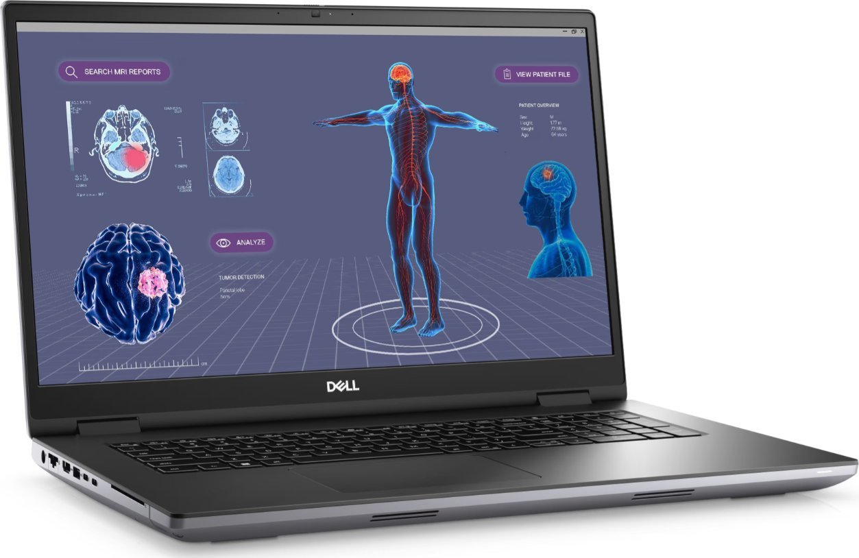 Лаптоп Dell Precision 7780, 17.3\", i7 13850HX, 32GB RAM, 1TB SSD, RTX 2000 8GB, црн
