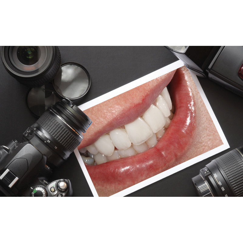 Dental Photo Set – Camera & Ring Light
